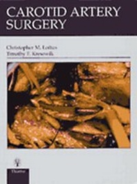 Abbildung von: Carotid Artery Surgery - Thieme Publishers