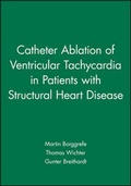 Cover: Catheter Ablation of Ventricular Tachycardia in Patients with Structural Heart Disease - Wiley