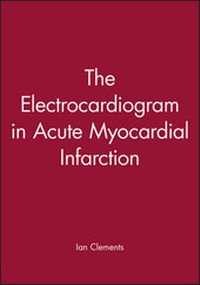 Enlarge image Cover: The Electrocardiogram in Acute Myocardial Infarction - Blackwell Futura