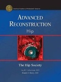 Cover: Advanced Reconstruction: Hip - American Academy of Orthopaedic Surgeons