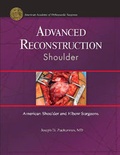 Cover: Advanced Reconstruction: Shoulder - American Academy of Orthopaedic Surgeons