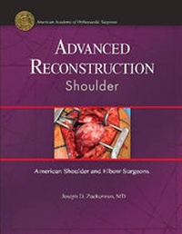 Enlarge image Cover: Advanced Reconstruction: Shoulder - American Academy of Orthopaedic Surgeons
