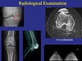 Cover: Adult Reconstruction Knee - American Academy of Orthopaedic Surgeons