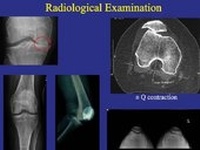 Enlarge image Cover: Adult Reconstruction Knee - American Academy of Orthopaedic Surgeons