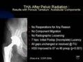 Cover: Adult Reconstruction Hip - American Academy of Orthopaedic Surgeons