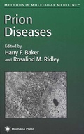 Cover: Prion Diseases - Humana