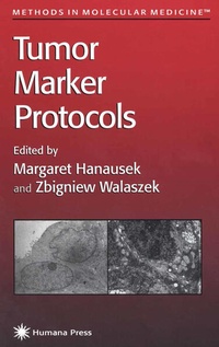 Enlarge image Cover: Tumor Marker Protocols - Humana Press Inc.
