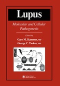 Cover: Lupus - Humana Press Inc.