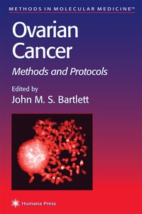 Abbildung von: Ovarian Cancer - Humana Press Inc.