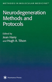 Abbildung von: Neurodegeneration Methods and Protocols - Humana
