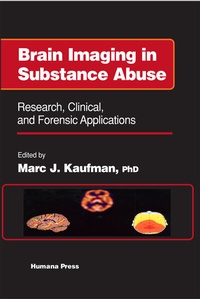 Abbildung von: Brain Imaging in Substance Abuse - Humana Press Inc.