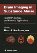 Cover: Brain Imaging in Substance Abuse - Humana