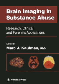 Enlarge image Cover: Brain Imaging in Substance Abuse - Humana