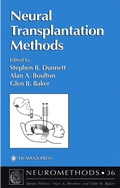Cover: Neural Transplantation Methods - Humana