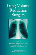 Bild: Lung Volume Reduction Surgery - Humana Press Inc.