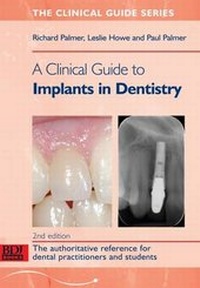 Abbildung von: A Clinical Guide to Implants in Dentistry - British Dental Journal