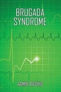Cover: Brugada Syndrome - Ebooks2go Inc