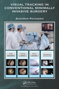 Abbildung von: Visual Tracking in Conventional Minimally Invasive Surgery - Chapman & Hall/CRC