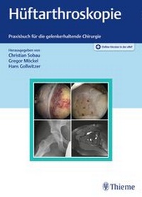 Abbildung von: Hüftarthroskopie - Thieme