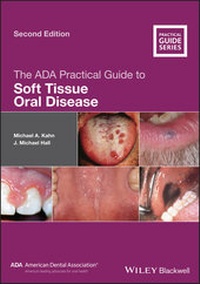 Enlarge image Cover: The ADA Practical Guide to Soft Tissue Oral Disease - Wiley