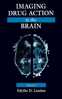 Abbildung von: Imaging Drug Action in the Brain - Routledge