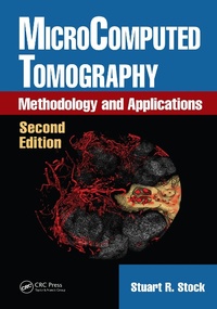 Abbildung von: MicroComputed Tomography - CRC Press