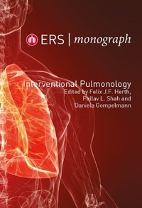 Abbildung von: Interventional Pulmonology - European Respiratory Society