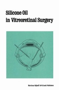 Cover: Silicone Oil in Vitreoretinal Surgery - Springer
