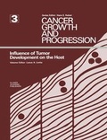Bild: Influence of Tumor Development on the Host - Springer