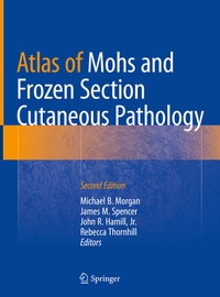 Abbildung von: Atlas of Mohs and Frozen Section Cutaneous Pathology - Springer