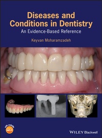 Abbildung von: Diseases and Conditions in Dentistry - Wiley