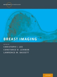 Enlarge image Cover: Breast Imaging - OUP eBook