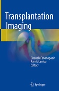 Bild: Transplantation Imaging - Springer
