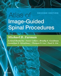 Abbildung von: Atlas of Image-Guided Spinal Procedures E-Book - Elsevier