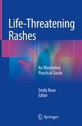 Cover: Life-Threatening Rashes - Springer