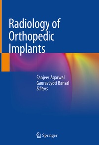 Abbildung von: Radiology of Orthopedic Implants - Springer
