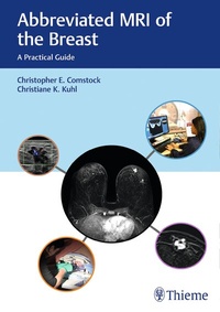 Abbildung von: Abbreviated MRI of the Breast - Thieme Publishers