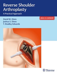 Abbildung von: Reverse Shoulder Arthroplasty - Thieme Publishers