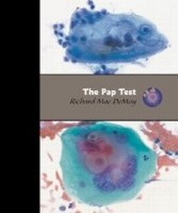 Abbildung von: The Pap Test - American Society of Clinical Pathologists Press
