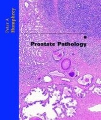 Enlarge image Cover: Prostate Pathology - American Society of Clinical Pathologists Press