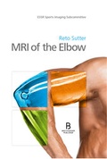Cover: MRI of the Elbow - Breitenseher Publisher