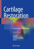 Cover: Cartilage Restoration - Springer