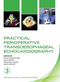 Enlarge image Cover: Practical Perioperative Transoesophageal Echocardiography - Oxford University Press