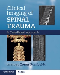 Abbildung von: Clinical Imaging of Spinal Trauma - Cambridge University Press