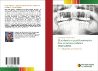 Abbildung von: Elucidando o posicionamento dos terceiros molares impactados - Novas Edicoes Academicas
