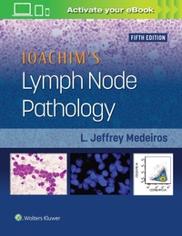 Abbildung von: Ioachim's Lymph Node Pathology - Lippincott Williams and Wilkins