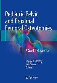 Abbildung von: Pediatric Pelvic and Proximal Femoral Osteotomies - Springer