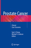 Cover: Prostate Cancer - Springer