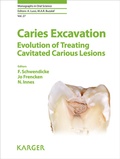 Cover: Caries Excavation: Evolution of Treating Cavitated Carious Lesions - S. Karger