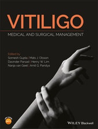 Enlarge image Cover: Vitiligo - Wiley